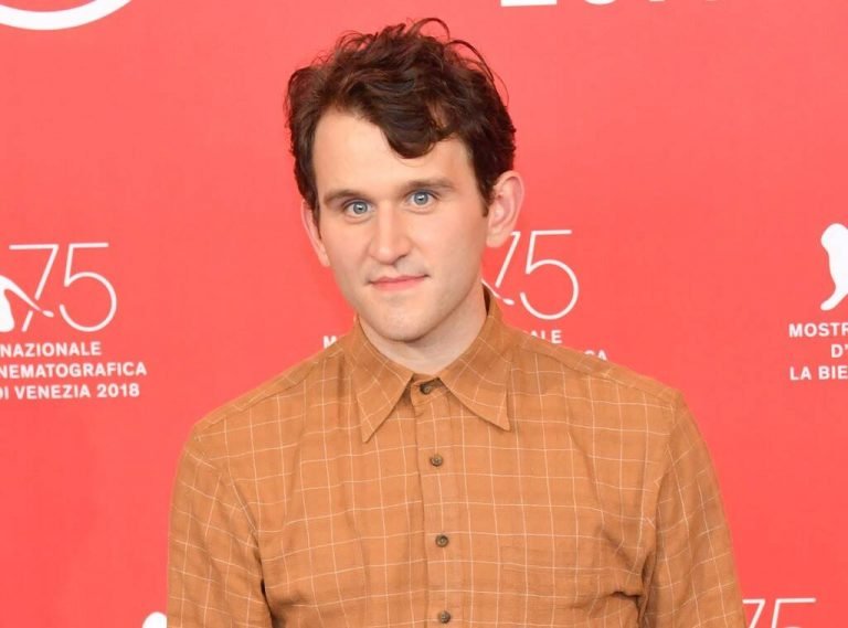 Harry Melling é escalado em longa com Christian Bale